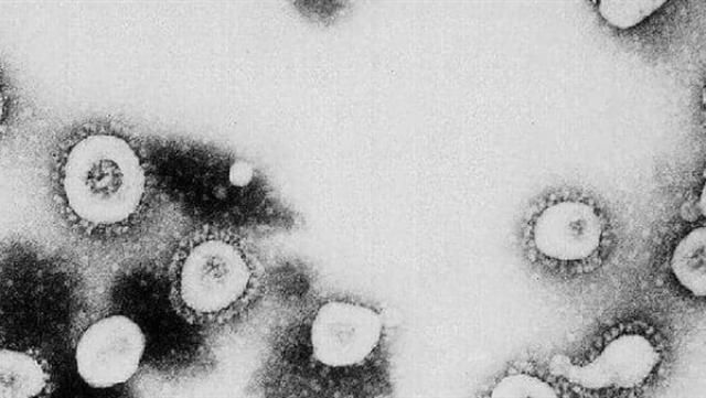 تسجيل 6345 إصابة جديدة بفيروس كورونا في المكسيك