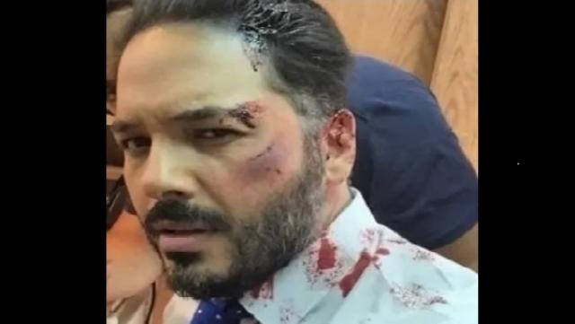 رامي عياش يكشف حقيقة صورته مضرجًا بالدم بعد الاعتداء عليه