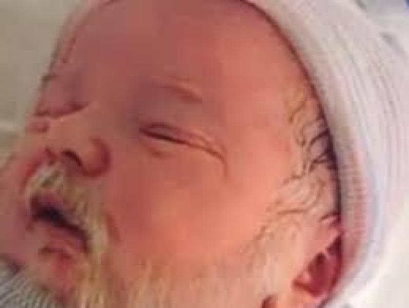 حقيقة الطفل الرضيع بلحية بيضاء ... تفاصيل صور الطفل الرضيع